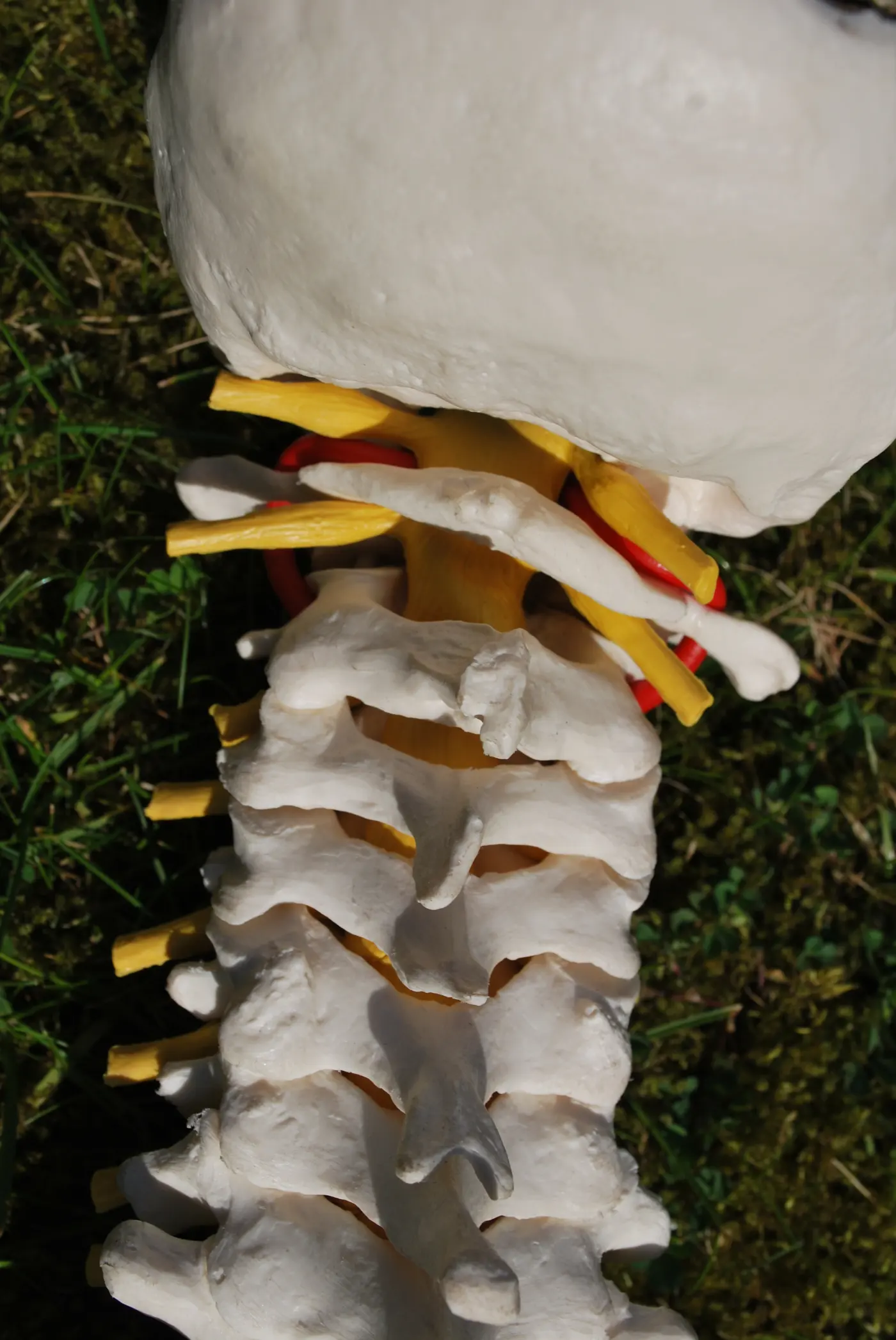 An anatomical model of the neck vertebrae seen from behind, with the arteries and nerves shown in colour