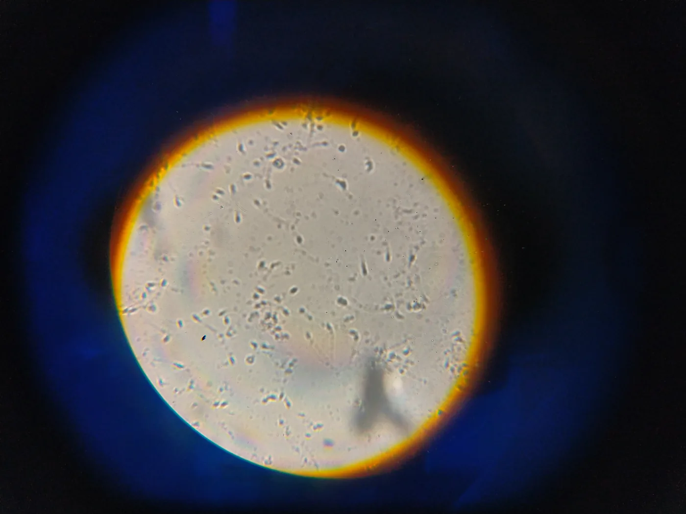 Human sperm cells seen through the eyepiece of a light microscope, as small dots with tails on a pale circular field
